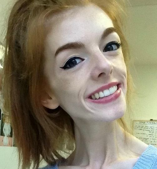 This woman only ate one piece of bread a day for 5 years