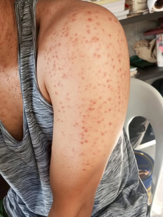 These are the consequences of sleeping with the…See more